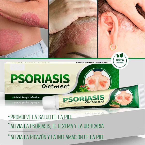 Crema Antifúngica y Antipicazón Jinyue – Tratamiento Natural para Tiña, Hongos y Psoriasis | 20g