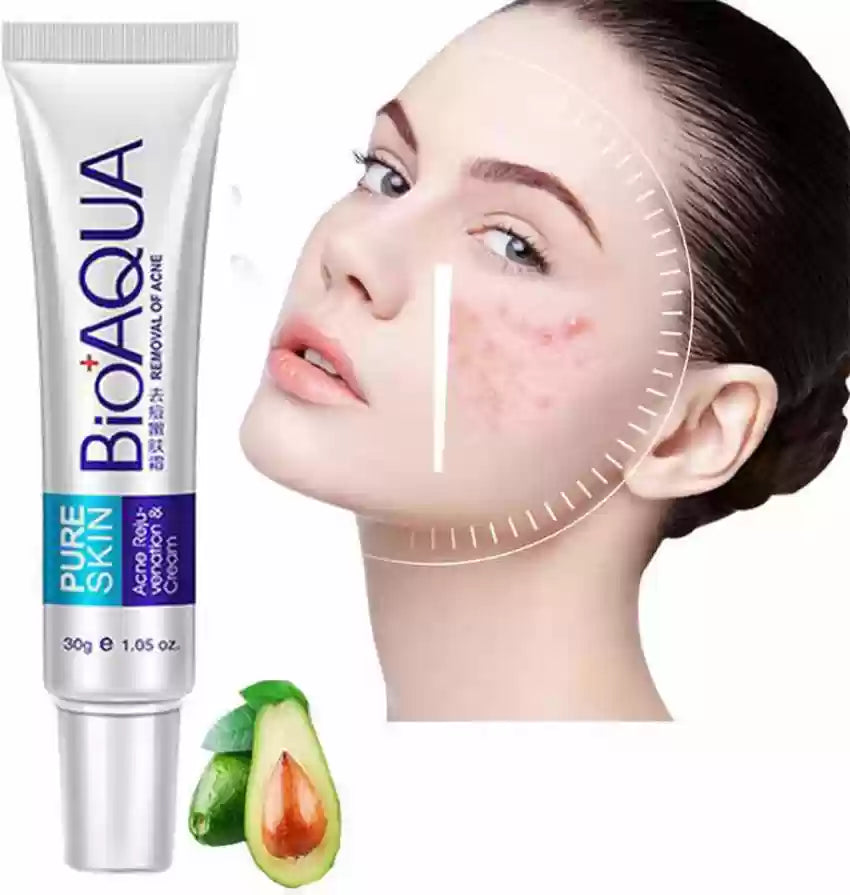 El Eliminador de Acné Definitivo