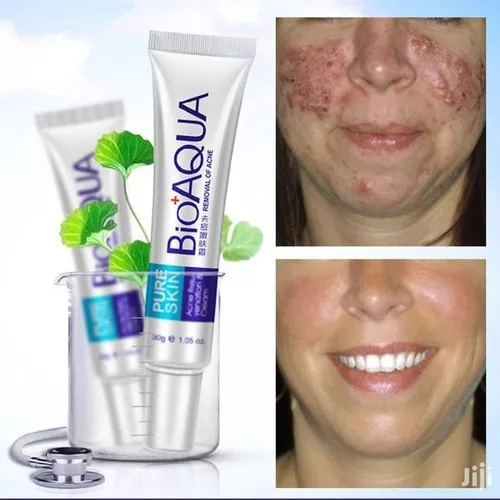 El Eliminador de Acné Definitivo